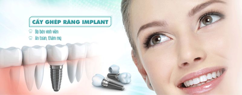 Nha khoa Quốc Tế Việt Pháp - Trồng răng Implant tốt và uy tín