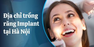 Top 10 địa chỉ trồng răng Implant uy tín và tốt nhất tại Hà Nội